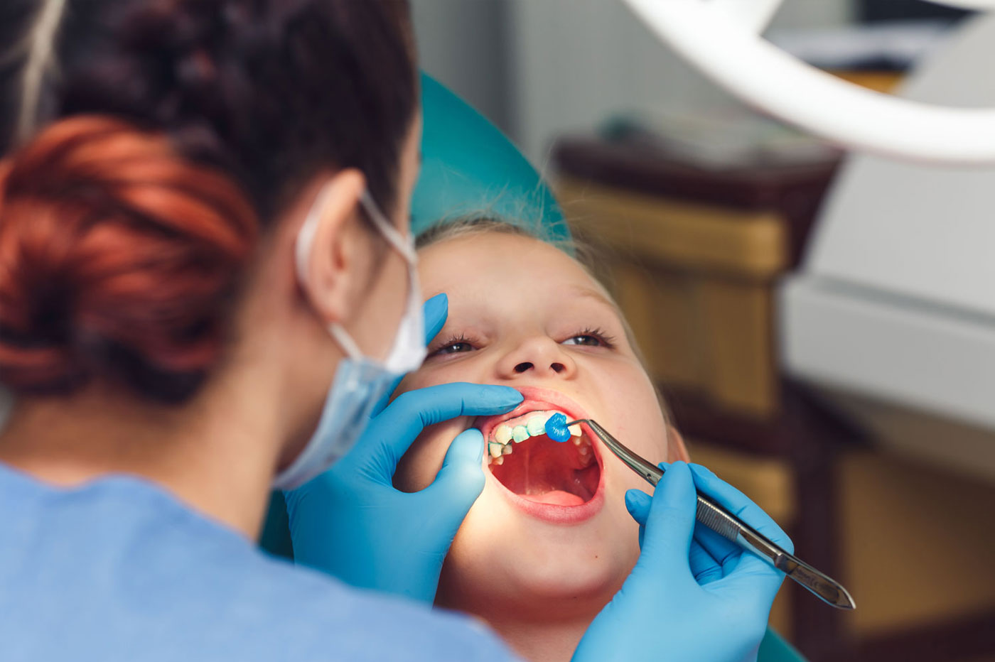 Fluoride Application