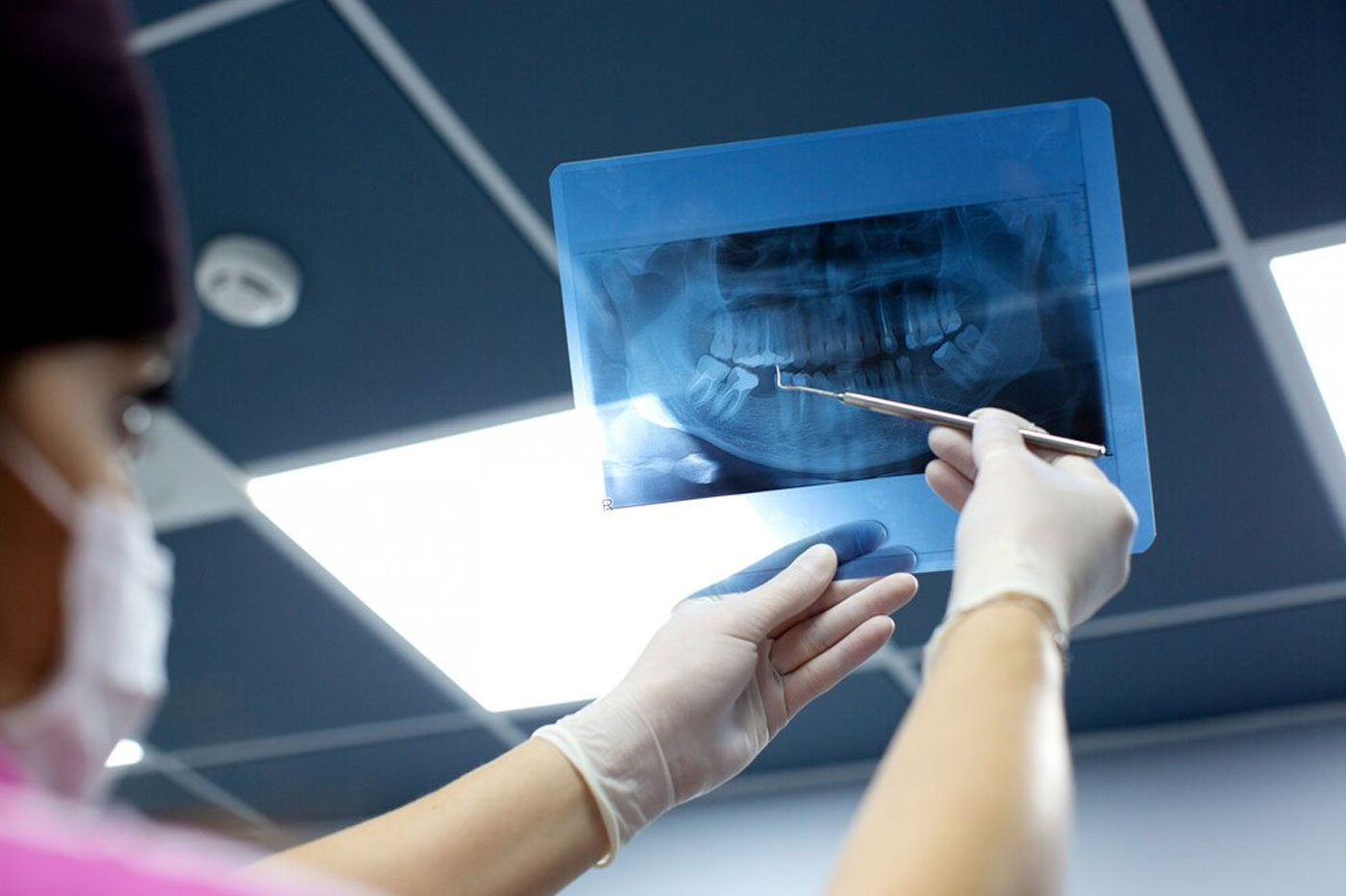 Intra Oral X-ray