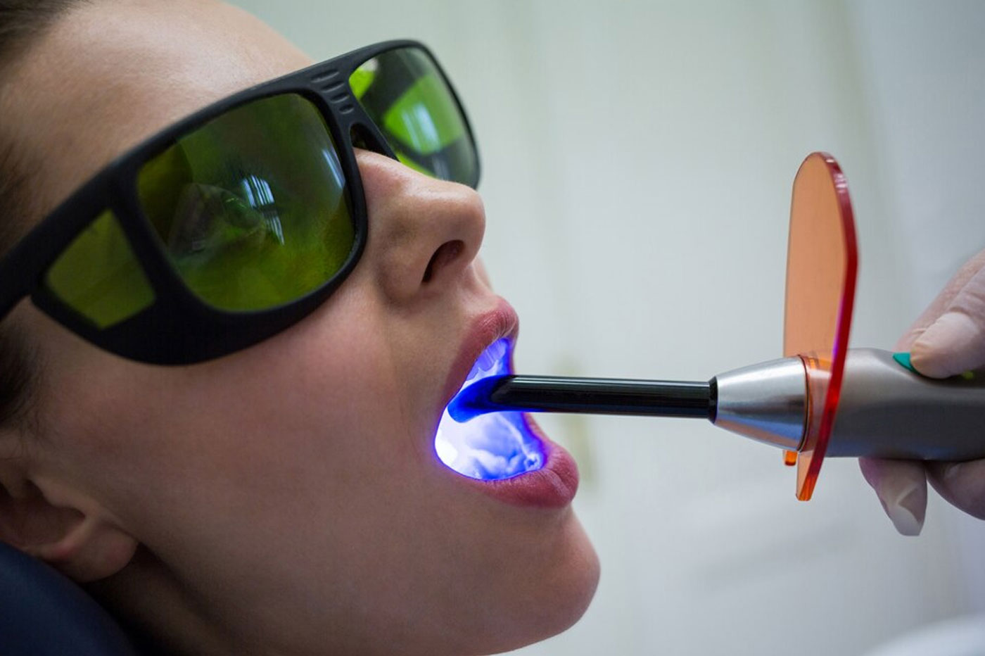 Laser Dentistry