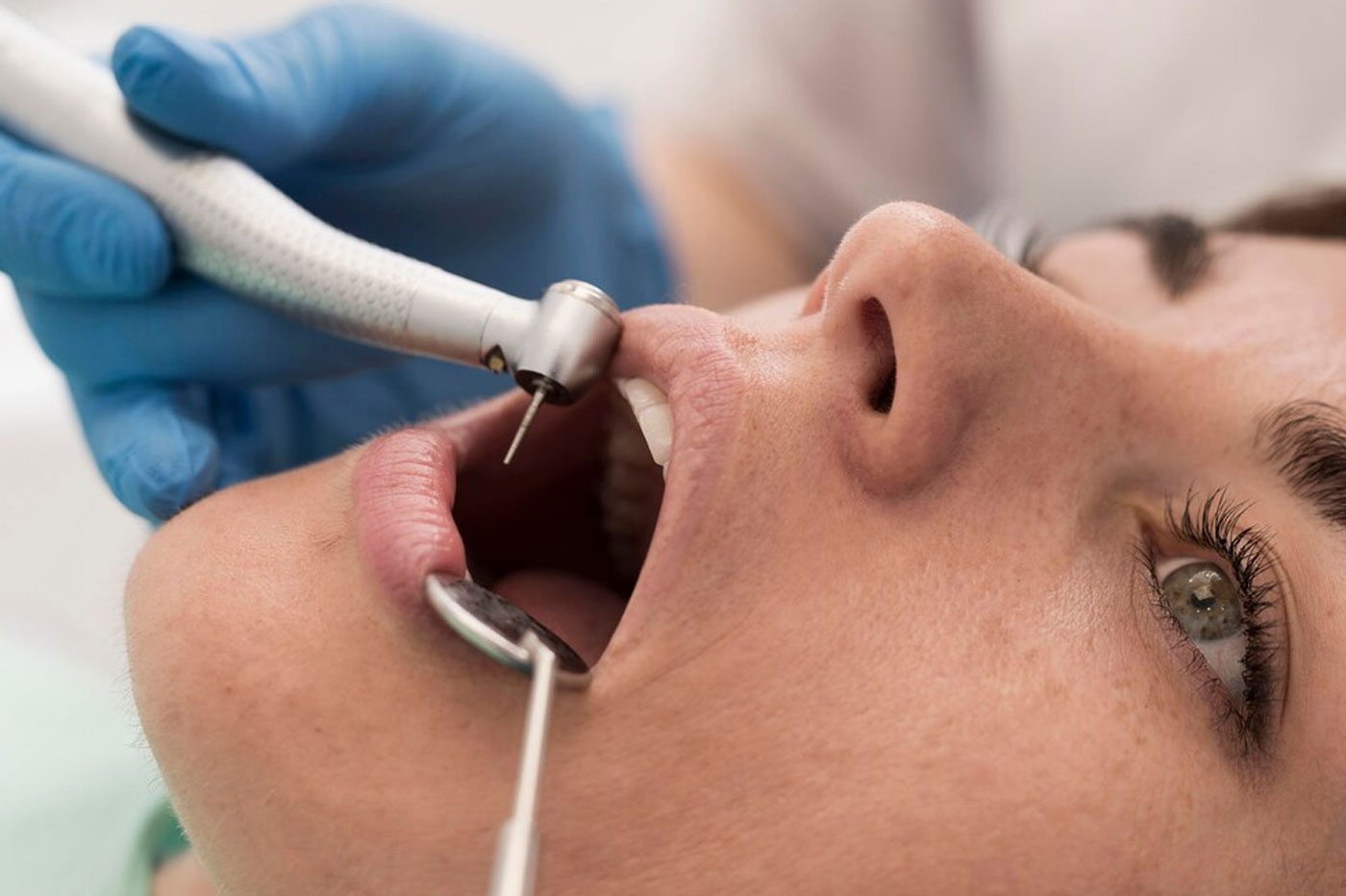 Painless Root Canal Treatment