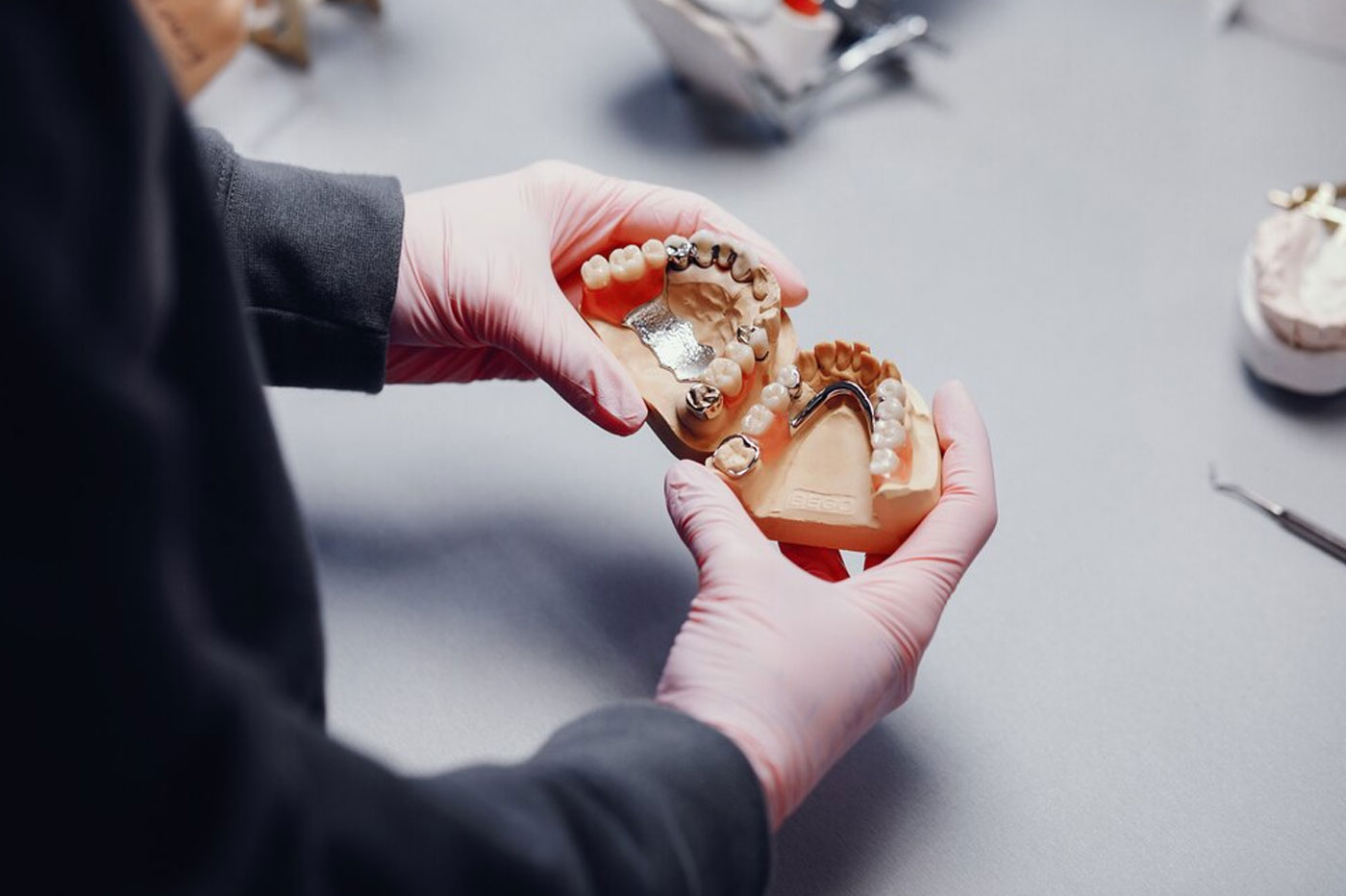 Partial Dentures