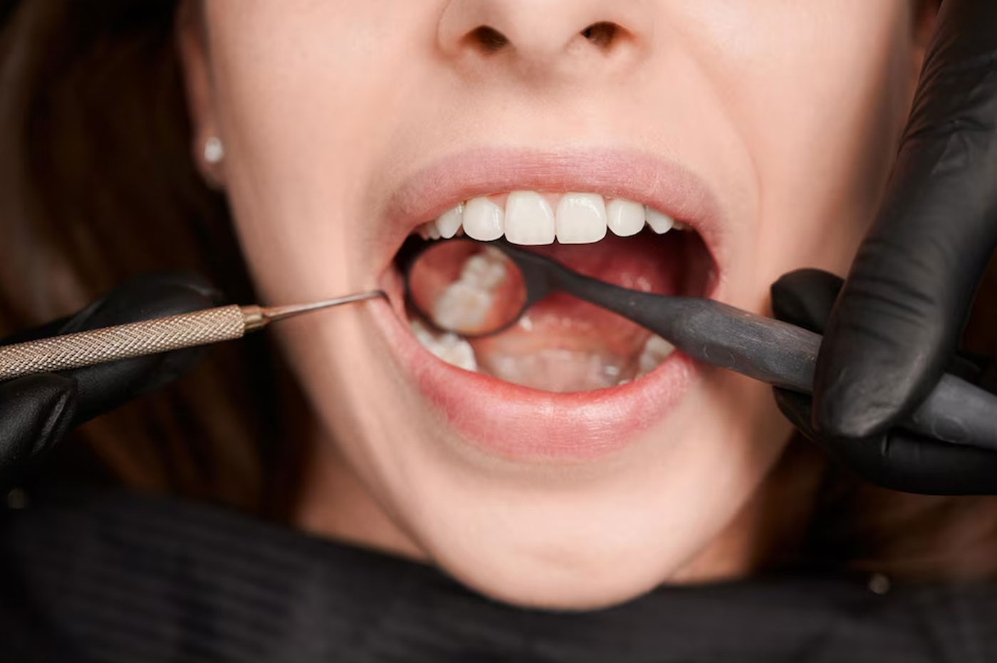 Tooth In One Hour