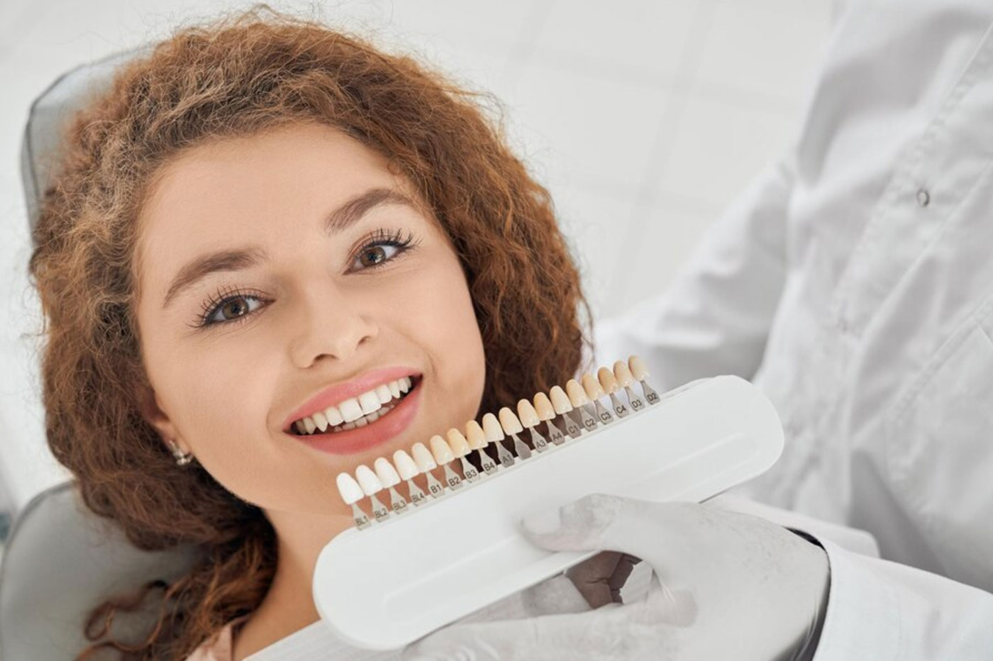 Veneers Laminates